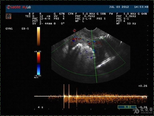 回声到底是怎么回事 回声到底是怎么回事