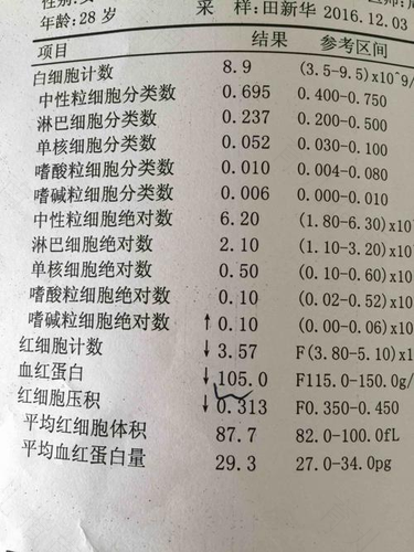 血常规怎么看贫血类型 血常规怎么看贫血类型