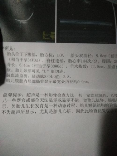 胎儿巨腹症发生的主要原因