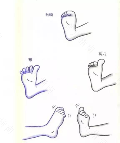 脚上有骨拐怎么办可以开刀吗