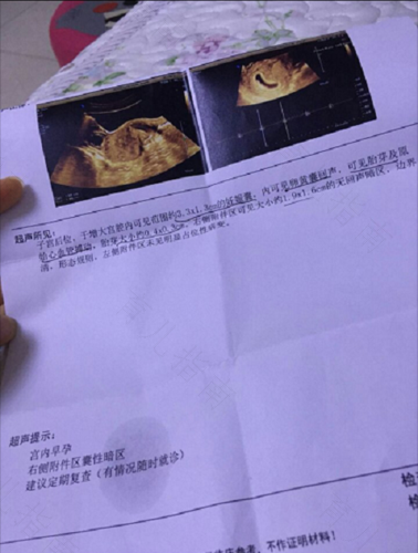 做输卵管检查可以吃饭吗 做输卵管检查可以吃饭吗