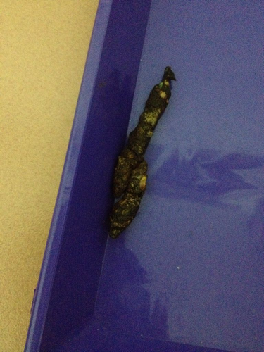 拉屎青黑色的是怎么回事