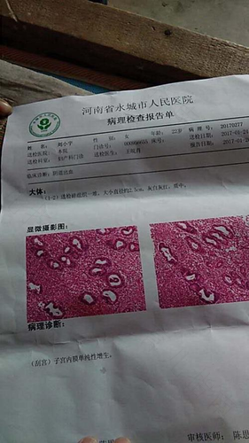 子宫内膜增生症怎么治疗 子宫内膜增生症怎么治疗