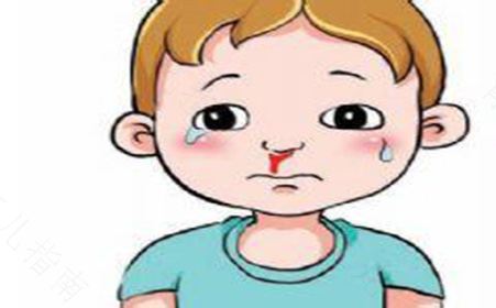 高烧后流鼻血怎么回事 高烧后流鼻血怎么回事