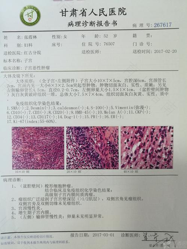 子宫腺肉瘤一期术后要化疗吗 子宫腺肉瘤一期术后要化疗吗