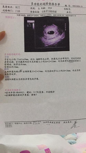 做阴超能查出什么问题 做阴超能查出什么问题