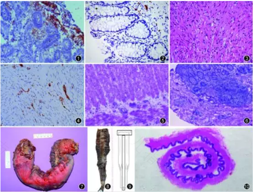 肠道神经发育不良怎么办 肠道神经发育不良怎么办