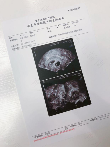 子宫内膜炎症怎么检查出来 子宫内膜炎症怎么检查出来