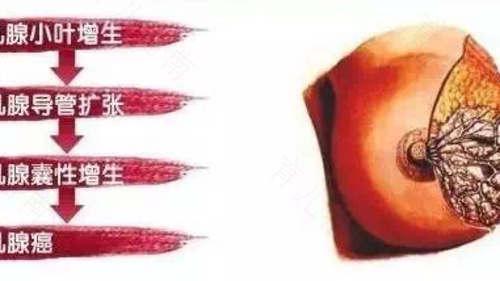 乳腺囊肿怎么调理最好 乳腺囊肿怎么调理最好