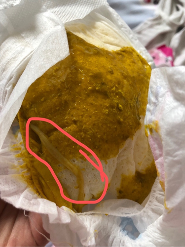 拉粘液大便是怎么回事 拉粘液大便是怎么回事