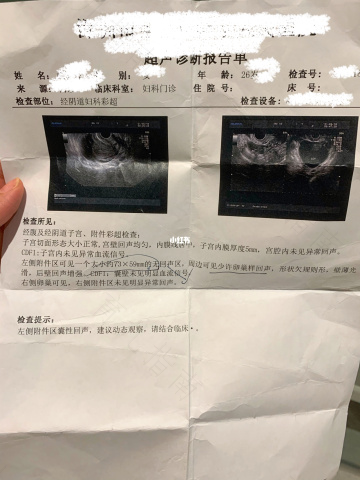 绝经后附件上长囊肿怎么办 绝经后附件上长囊肿怎么办