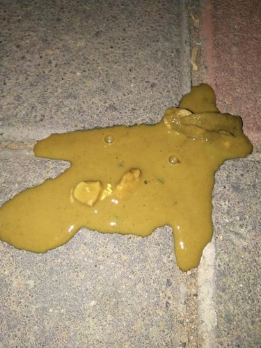 大人拉肚子拉的都是水怎么办 大人拉肚子拉的都是水怎么办