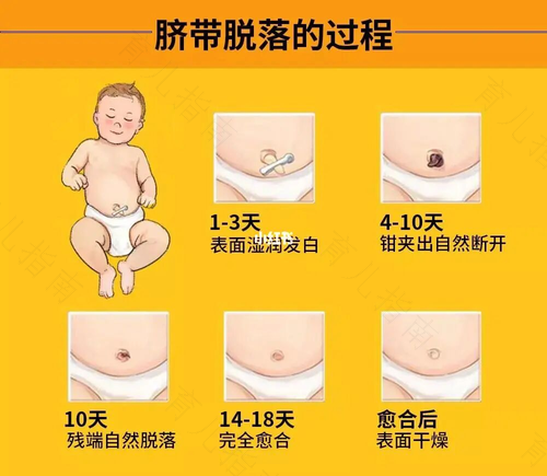 老人肚脐出水是怎么回事 老人肚脐出水是怎么回事