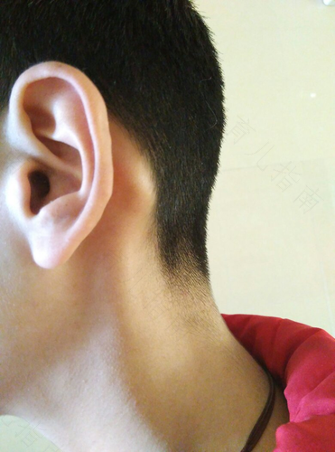 鼻塞引起一侧耳朵疼是怎么回事 鼻塞引起一侧耳朵疼是怎么回事