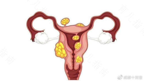 生气的时候子宫疼是怎么回事