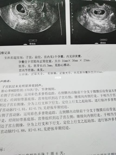 做阴超几分钟能好 做阴超几分钟能好