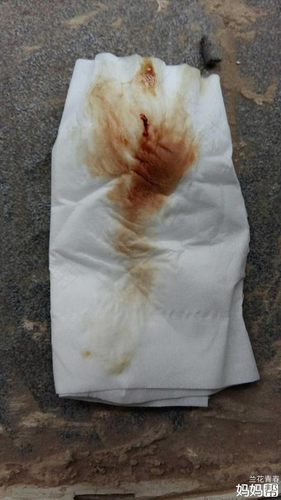 做一次人流以后还能生育吗