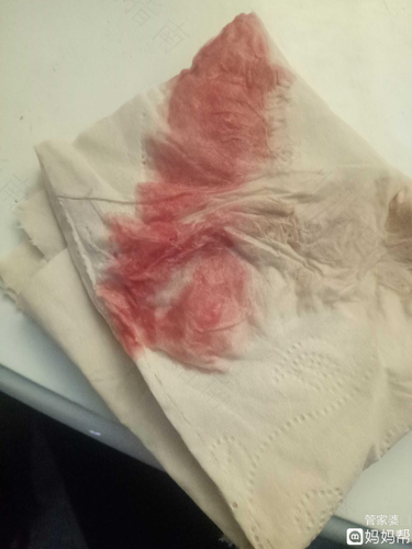 月经血量大时间长怎么办 月经血量大时间长怎么办