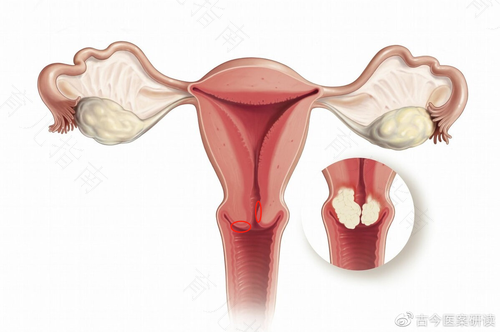 子宫的左侧疼怎么回事 子宫的左侧疼怎么回事