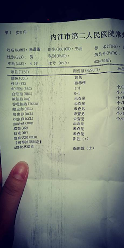 a群轮状病毒阳性怎么治疗 a群轮状病毒阳性怎么治疗