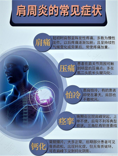 肩周炎怎么引起的怎么治疗 肩周炎怎么引起的怎么治疗