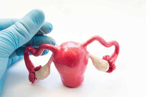 良性子宫肌瘤会出血吗 良性子宫肌瘤会出血吗