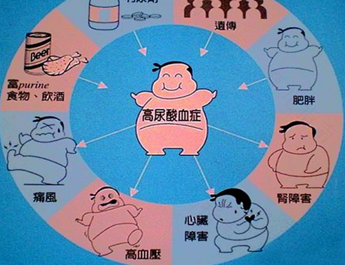 怎么知道尿酸高有什么症状