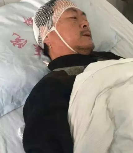 摔到头部起包怎么办 摔到头部起包怎么办