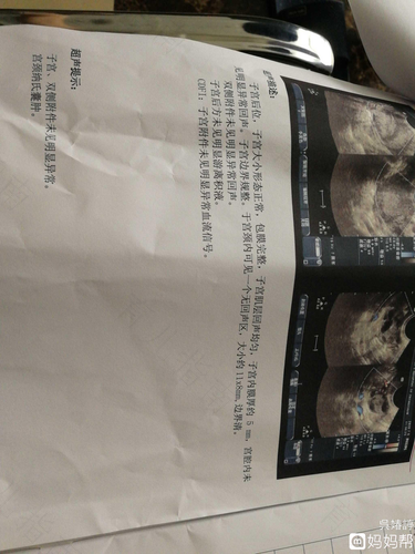 纳氏囊肿严不严重 纳氏囊肿严不严重