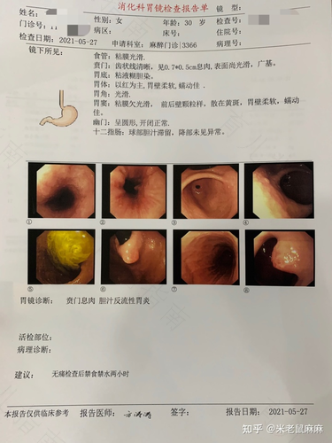 慢性胃炎会引起大便不畅吗 慢性胃炎会引起大便不畅吗