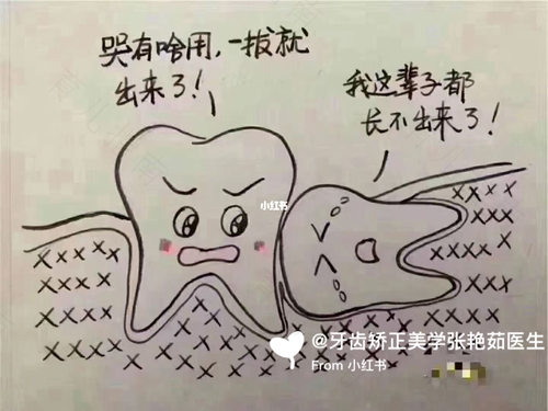 上面的智齿不痛需要拔吗 上面的智齿不痛需要拔吗