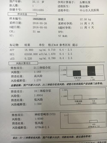 唐氏筛查21三体综合症高风险怎么办 唐氏筛查21三体综合症高风险怎么办
