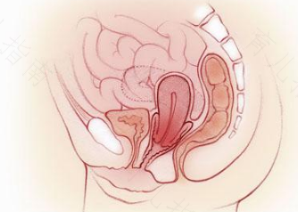 子宫脱落怎么治疗