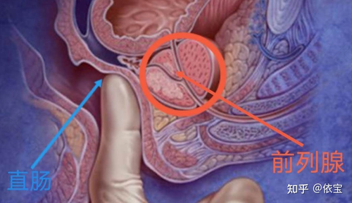 男人前列腺是怎么引起的