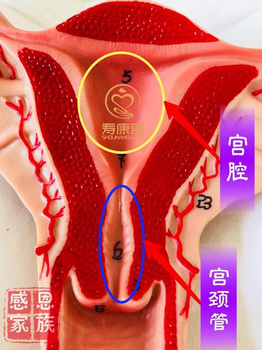 宫颈管里有东西会是什么 宫颈管里有东西会是什么