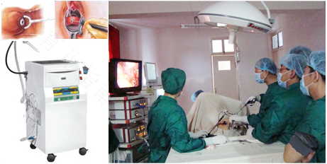 宫颈手术后要休息多久时间最好 宫颈手术后要休息多久时间最好