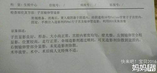 输卵管堵塞会引起多囊卵巢吗