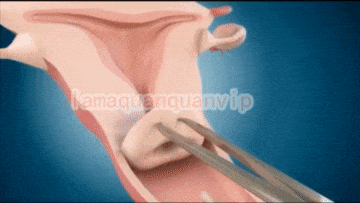 感觉子宫疼是怎么回事 感觉子宫疼是怎么回事