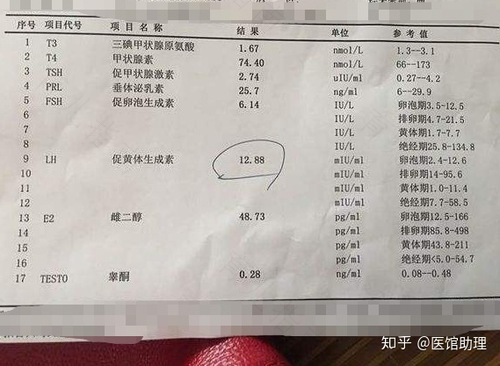 性激素检查是查什么病 性激素检查是查什么病