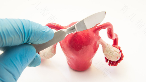 宫颈囊肿不处理会怎样? 宫颈囊肿不处理会怎样?