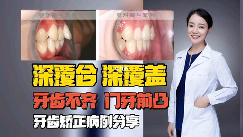 35岁还能矫正牙齿么 35岁还能矫正牙齿么