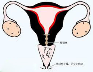 排卵期堵塞的症状 排卵期堵塞的症状