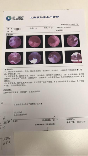 宫腔粘连做宫腔镜手术痛吗