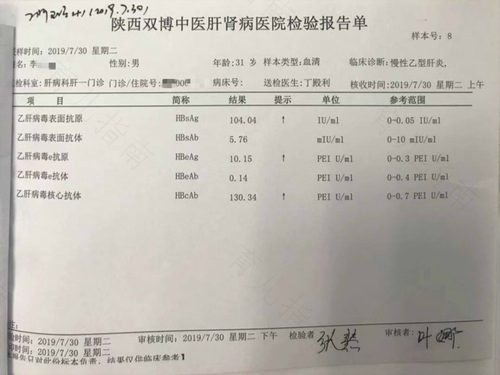 肝功能五项是抽血检查吗 肝功能五项是抽血检查吗