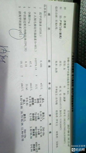 游离t4偏低是什么意思 游离t4偏低是什么意思