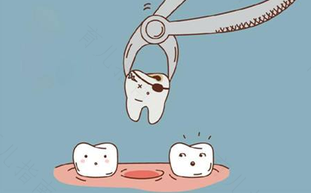 智齿无痛拔牙真的不痛吗 智齿无痛拔牙真的不痛吗