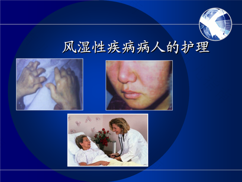 干燥性风湿是什么病