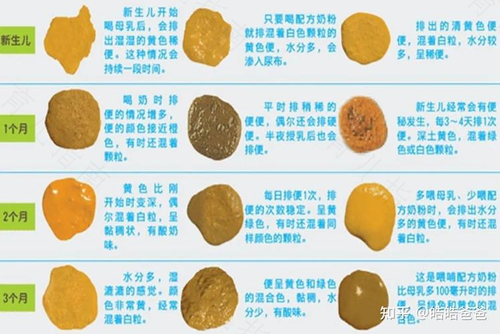 大便有点白是怎么回事 大便有点白是怎么回事