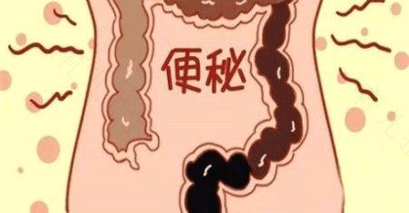 长期便秘的危害有哪些? 长期便秘的危害有哪些?