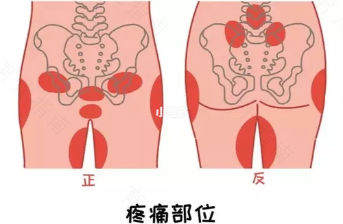 耻骨旁边疼痛怎么回事 耻骨旁边疼痛怎么回事